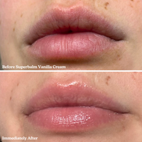 Blume Lip Balm Trio Kit