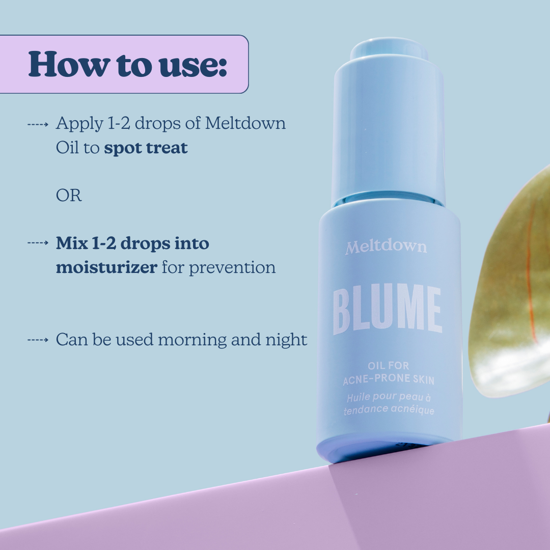 Hormonal Acne Kit
