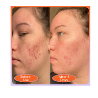 Milky Fade Serum