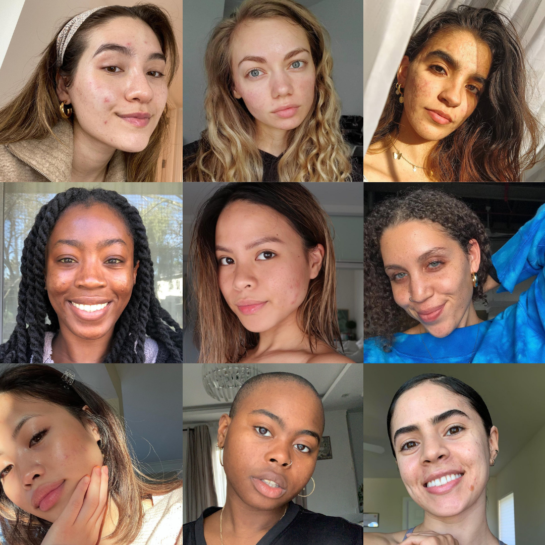 Blume Redefines P*rfect Skin