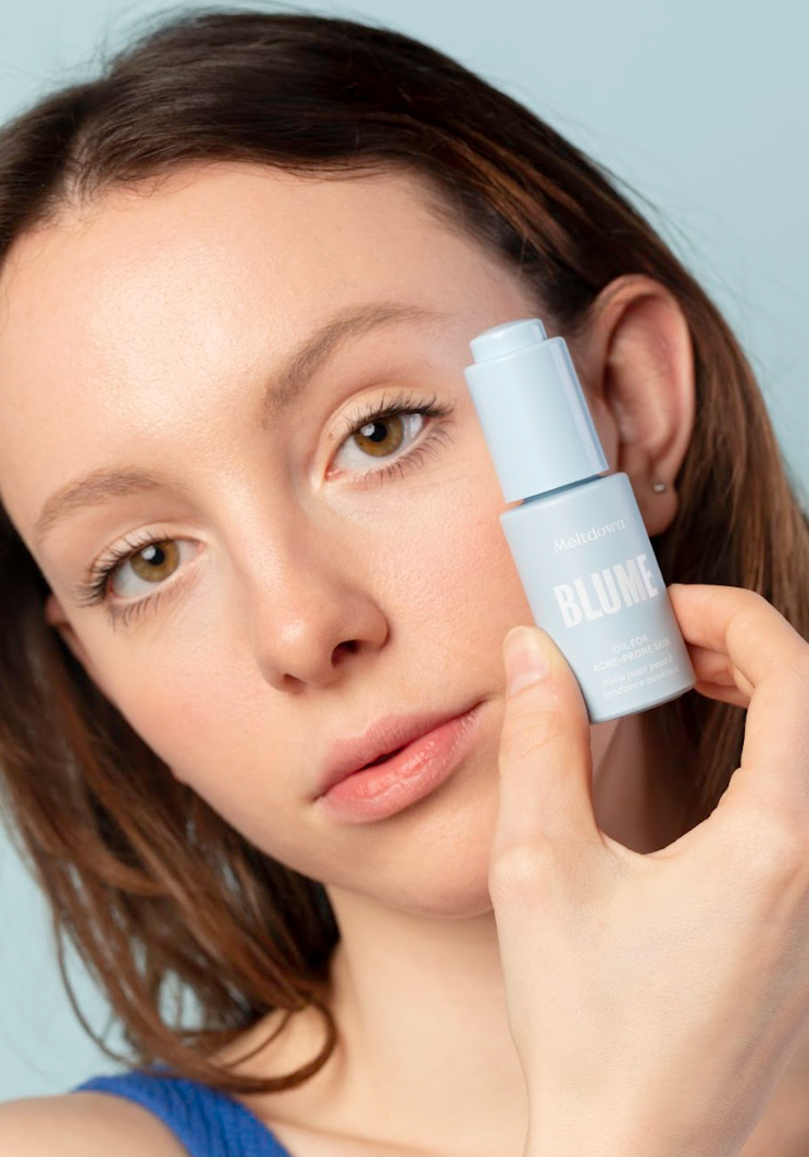How to Treat Acne Prone Skin: A Dermatologist’s Expert Opinion