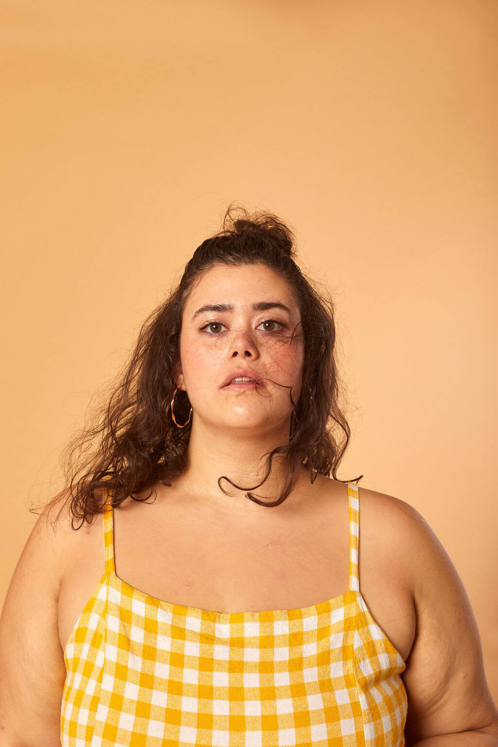 What Causes Adult Acne and How Can It Be Prevented?
