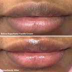Blume Lip Balm Trio Kit