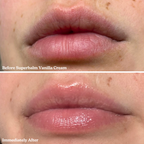 Blume Lip Balm Trio Kit
