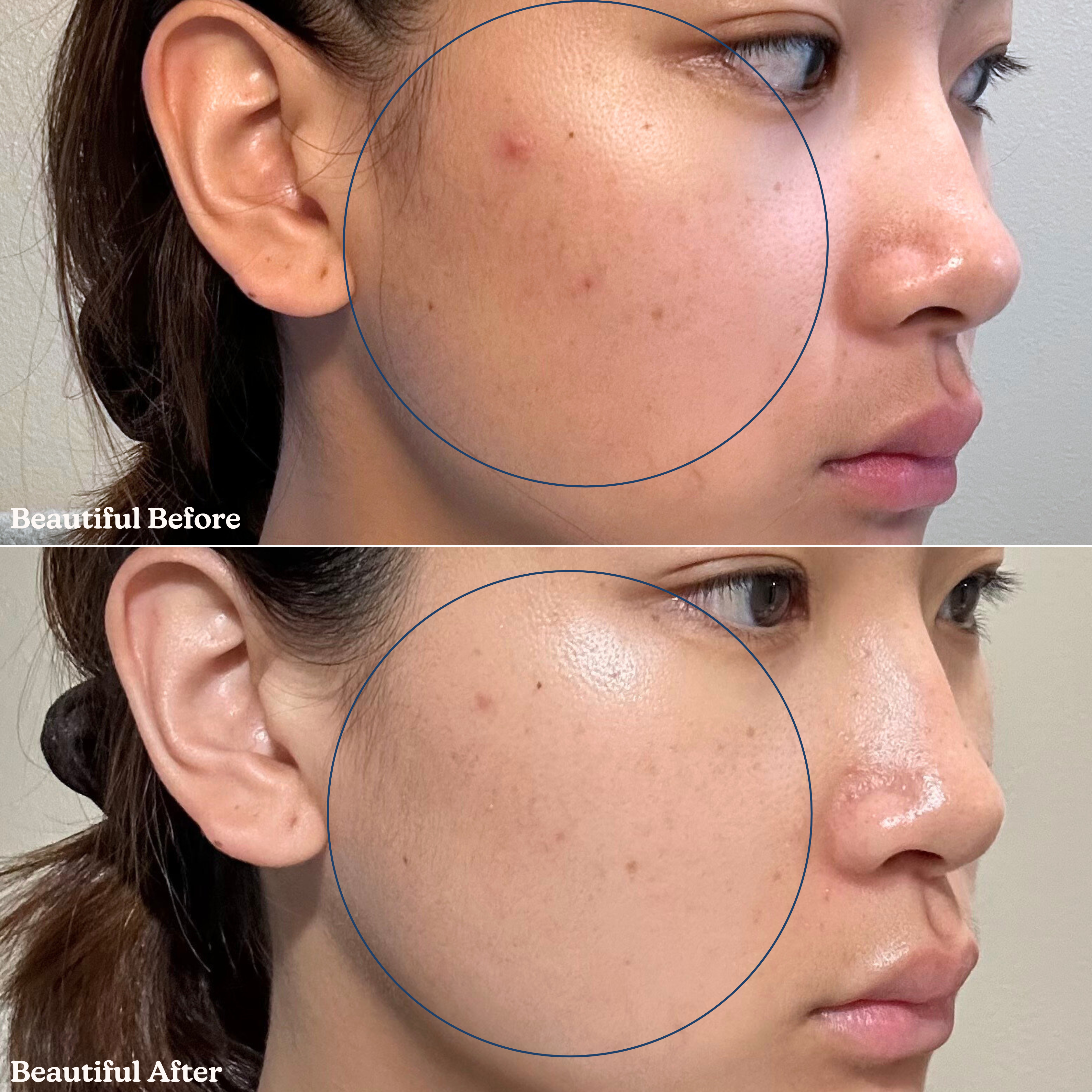 Pearl Drip Soothing + Hydration Milky Toner