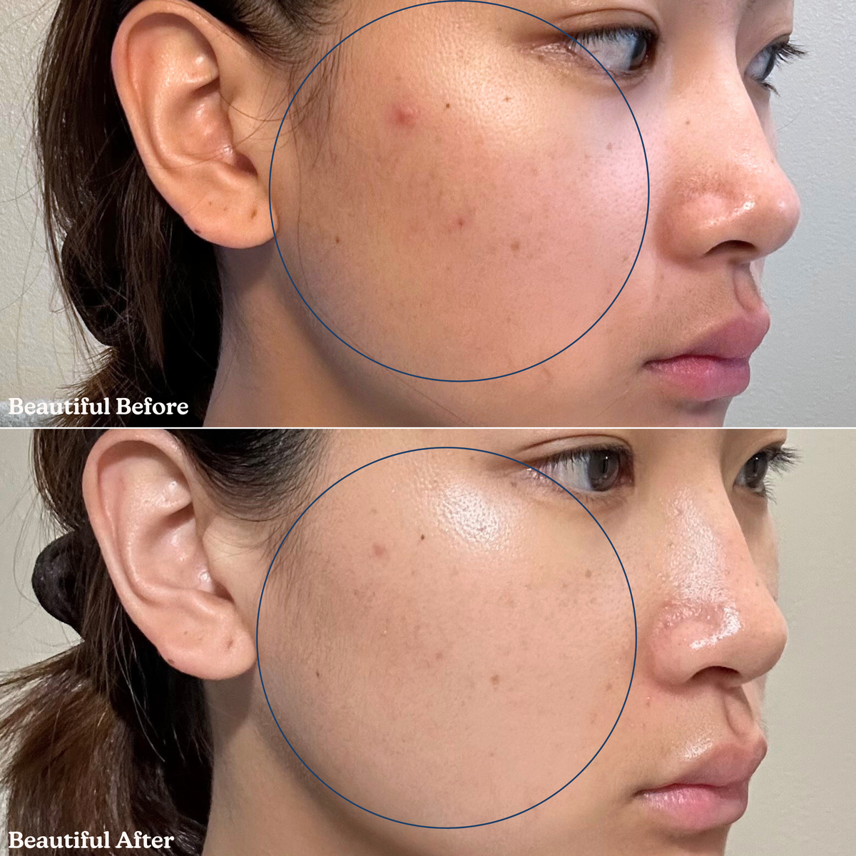 Pearl Drip Soothing + Hydration Milky Toner