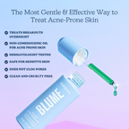 The Ultimate Acne Routine