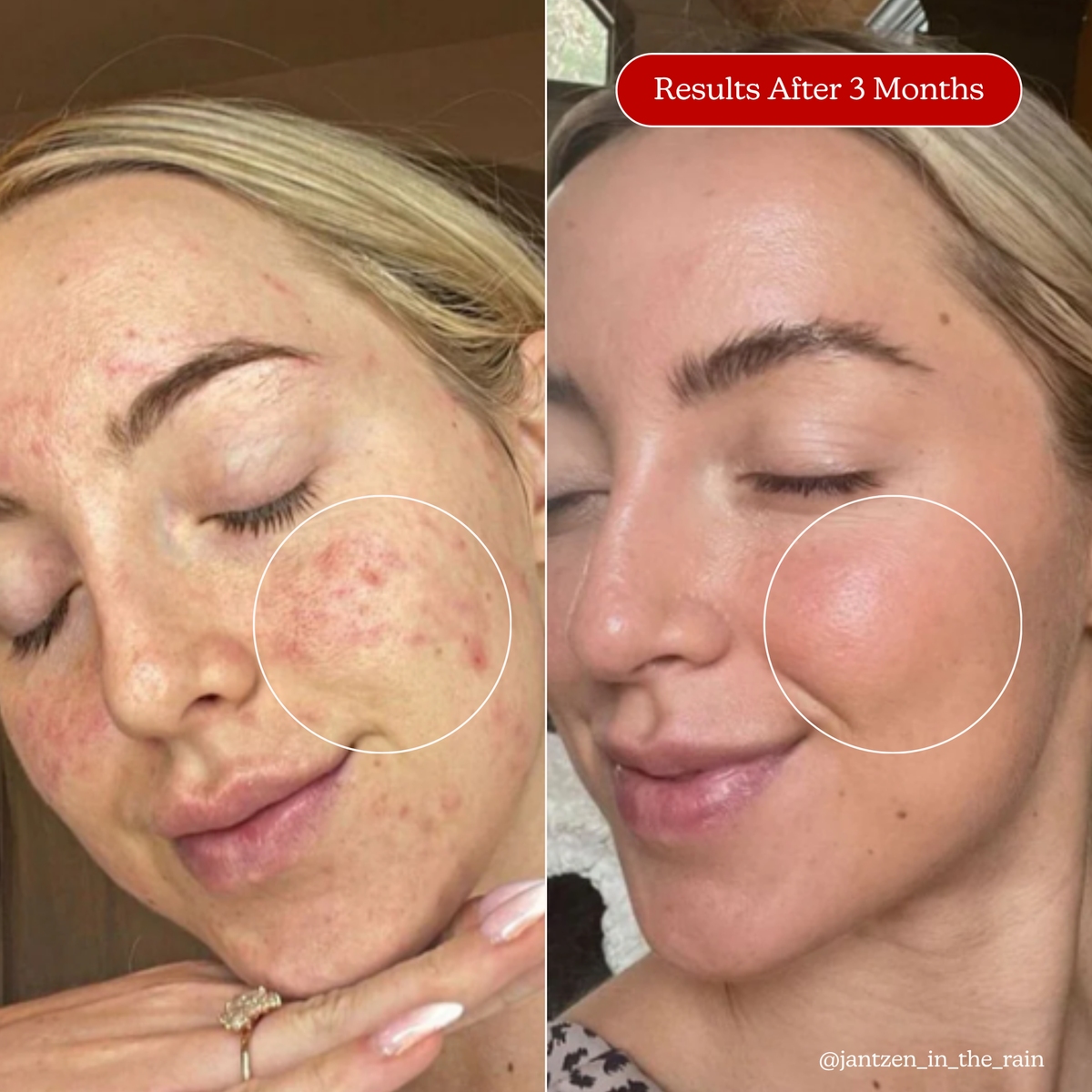 Clarifying Routine Holiday Kit