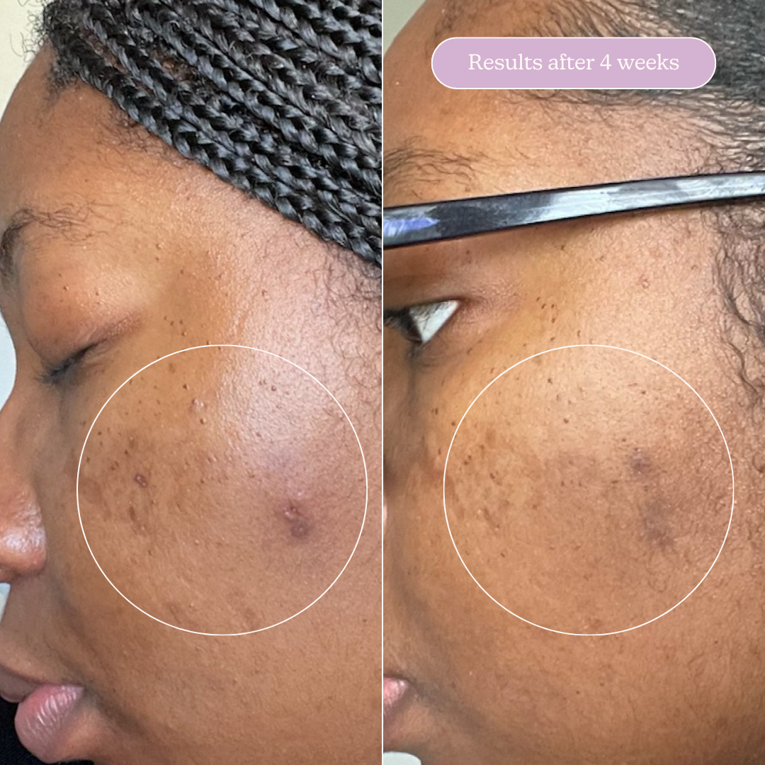 Milky Fade Serum with Niacinamide for Spots & Scars