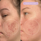 Milky Fade Serum with Niacinamide for Spots & Scars