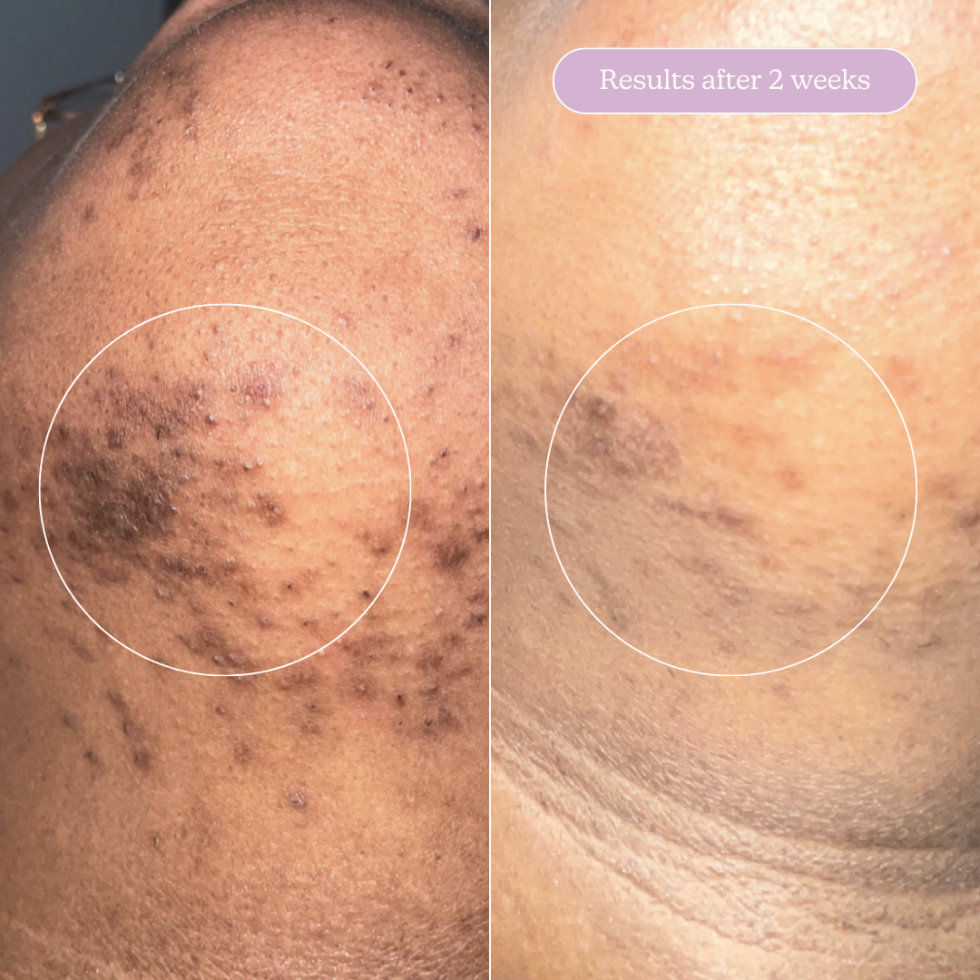 Milky Fade Serum with Niacinamide for Spots & Scars